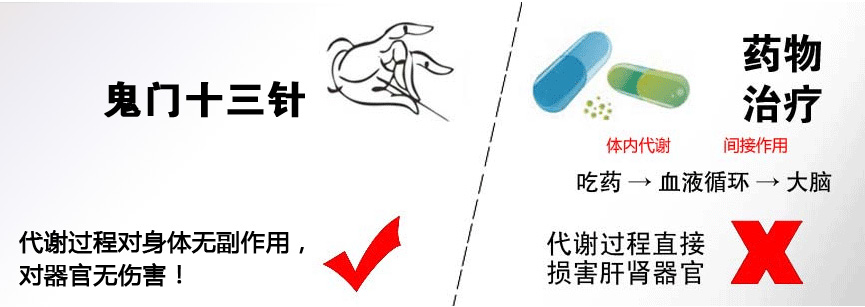 “新鬼门十三针”治疗抑郁症 “针”到病除